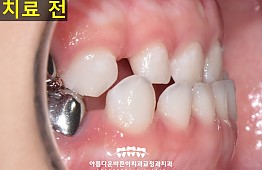 수술전