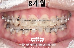 수술후