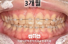 수술후