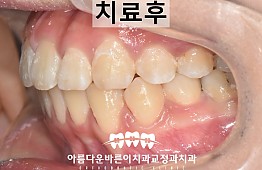 수술후