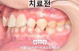 수술전