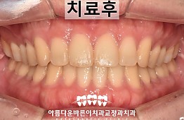 수술후