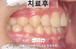 수술후