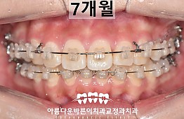 수술후