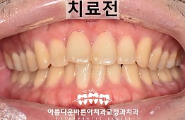 수술전