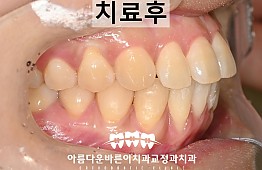 수술후