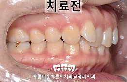 수술전