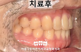 수술후