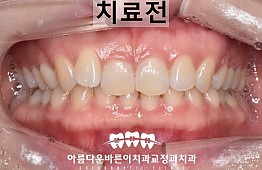 수술전