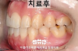 수술후