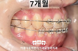 수술후