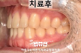 수술후