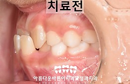 수술전