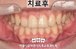 수술후