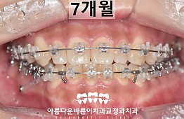 수술후