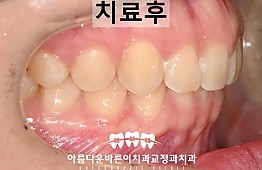 수술후