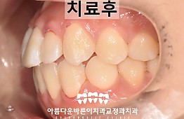 수술후