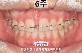 수술후