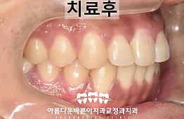 수술후