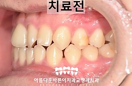 수술전