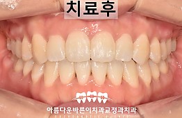 수술후