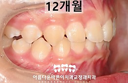 수술후