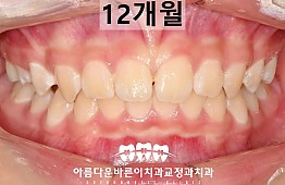 수술후