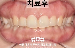 수술후