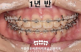 수술후