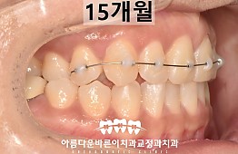 수술후