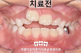 수술전