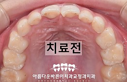 수술전