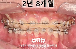 수술후