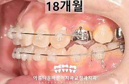 수술후