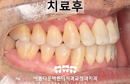 수술후