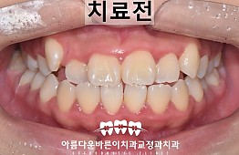 수술전