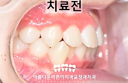 수술전