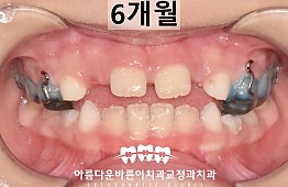 수술후