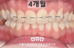 수술후