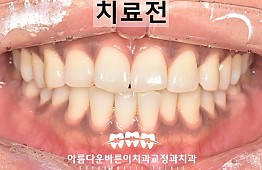 수술전