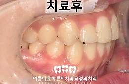 수술후