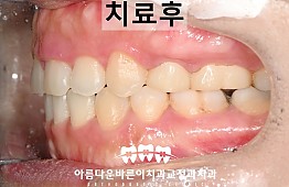 수술후