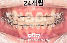 수술후