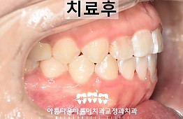 수술후