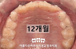 수술후