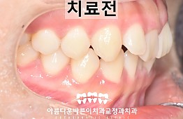 수술전