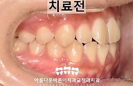 수술전