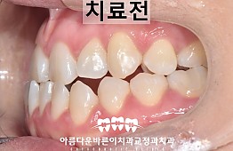 수술전