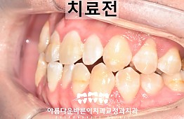 수술전