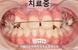 수술후